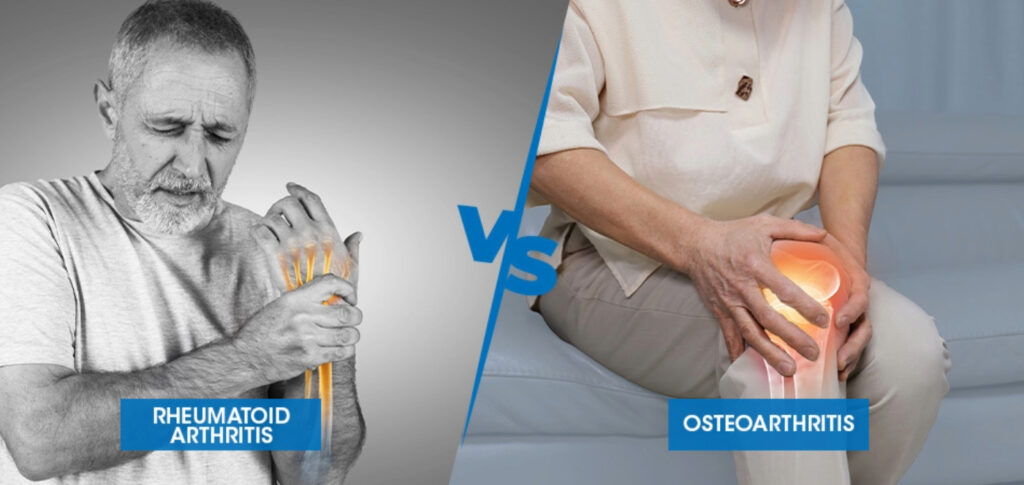 OA vs RA